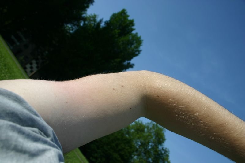 My multicoloured arm