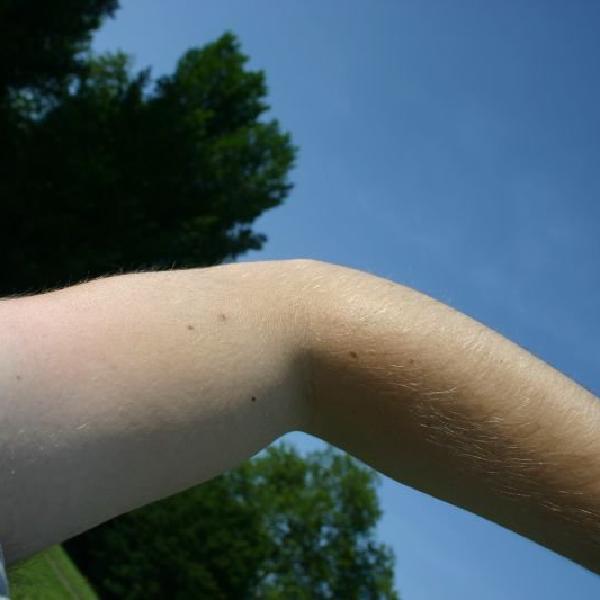 My multicoloured arm